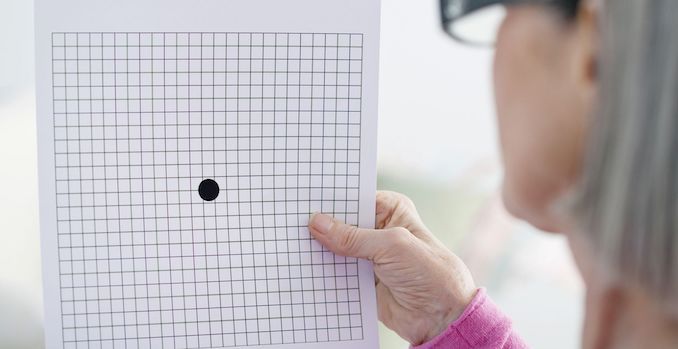 Degeneración macular relacionada a la edad - DMRE